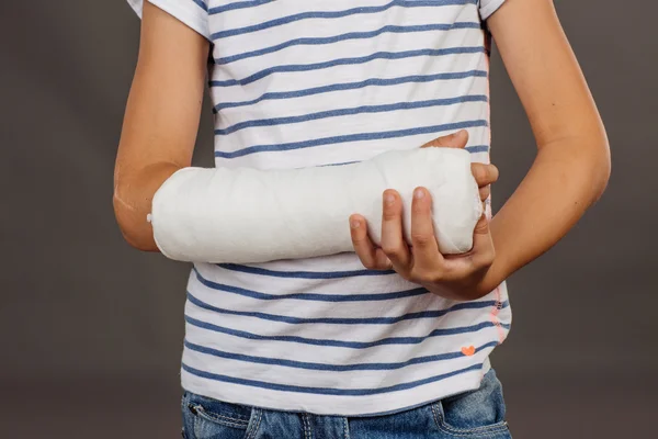 Nahaufnahme eines gebrochenen Arms im Cast auf gestreiftem Hemdhintergrund — Stockfoto