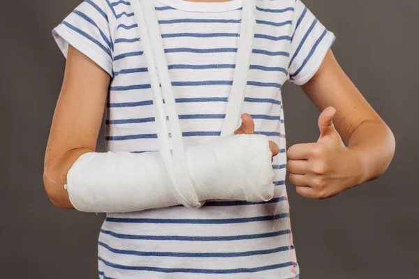 Close-up of a broken arm in a cast on striped shirt  background — Stockfoto