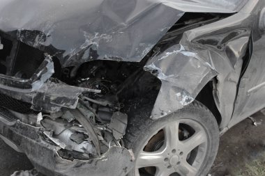 Araba kazası, siyah arabanın ön tarafı hasar görmüş. Aracın ön tarafı kırılmış ve feci şekilde kırılmış. Servis ve otobüs durağında arabanın tamire ihtiyacı var. Araba bir lambayla çılgına döndü.