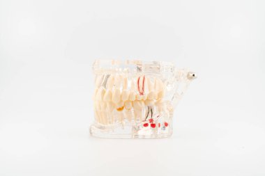 Beyaza izole edilmiş titanyum implantları olan temiz anatomik diş modeli.