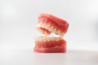 Görünmez diş telleri beyaz arka planda izole edilmiş.