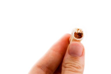 İzole edilmiş beyaz bir arka planda hastalıklı bir dişin yakın çekimi. Diş ağrısının sebebi. Kırık diş.. 