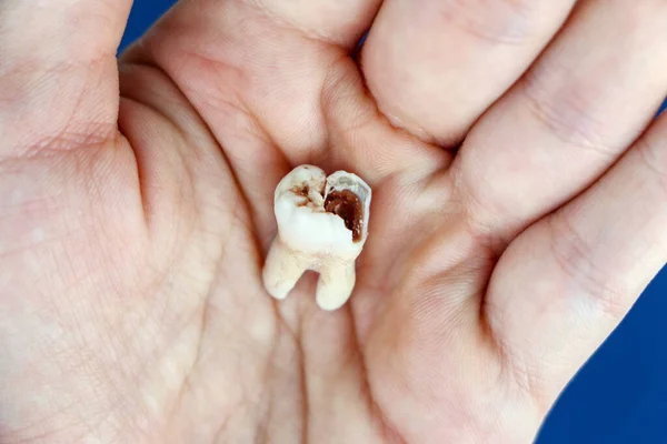 Ağrıyan bir dişin kapağını kapat. Diş ağrısı..