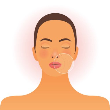 Güzellik Stüdyosu Şablonu. Genç Kadın Yüzünde Büyütme Çemberi Problem Derisi Gösterimi. Sosyal Medya Sancakları.