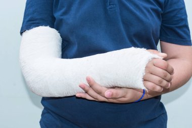 Arm in cast or bandage  boy with broken bone  closeup of caucasian kid with arm plaster  cast terapy cover  bandage after accident  closeup of guy broken arm in plaster cast 