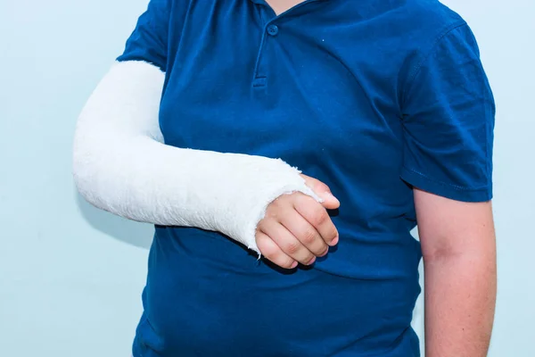 Arm Gips Oder Verband Junge Mit Gebrochenem Knochen Nahaufnahme Von — Stockfoto