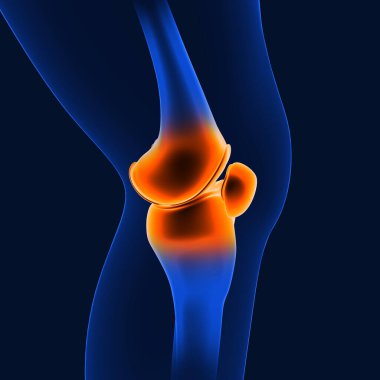 Eklem ağrısı bağ dokuları, bursae ya da eklemleri çevreleyen tendonları etkileyen yaralanmalardan kaynaklanabilir..