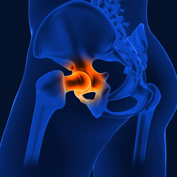 Боль в суставах может быть вызвана повреждением любой из связок, бурса или сухожилий, окружающих сустав..