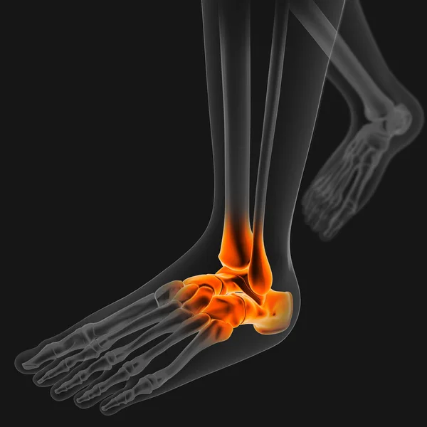 Gewrichtspijn Kan Worden Veroorzaakt Door Letsel Dat Een Van Ligamenten — Stockfoto