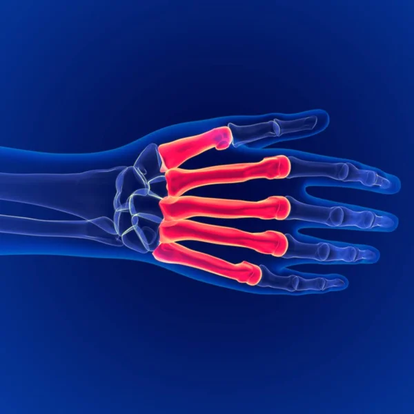 Emberi Csontváz Anatómia Metacarpals Csontok Dorsal Side Rendering Medical Concept — Stock Fotó