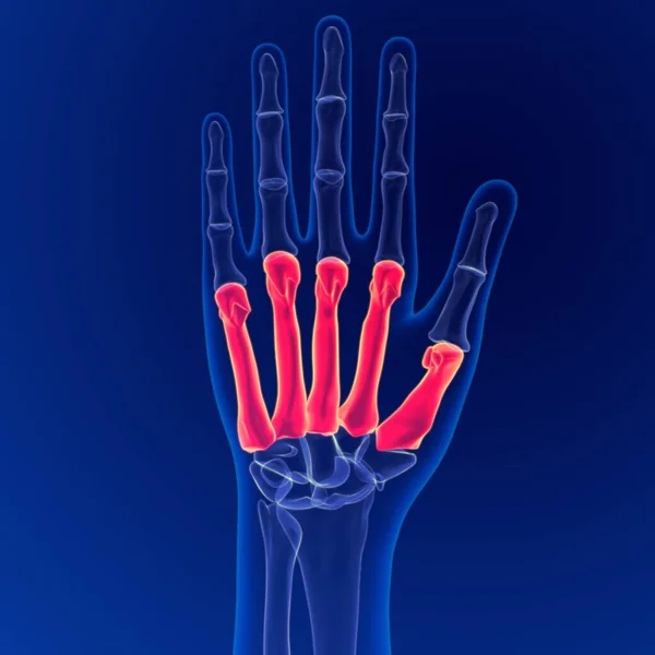 Anatomie Des Menschlichen Skeletts Metacarpals Bones Rendering Für Medizinisches Konzept — Stockfoto