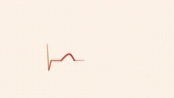 HeartBeat Cardiogram on Grid Background. — Stock Video