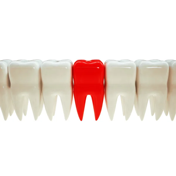 Teeth and red tooth symbolizes pain — Stockfoto