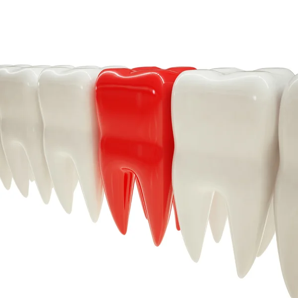 Teeth and red tooth symbolizes pain — Stockfoto