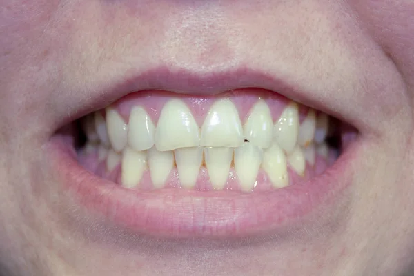 Sorriso Feminino Perto Lábios Femininos Sem Batom Dentes Humanos — Fotografia de Stock