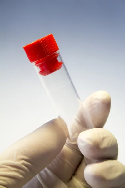 Hands in medical gloves holding empty plastic tube with red cap — Stock Photo, Image