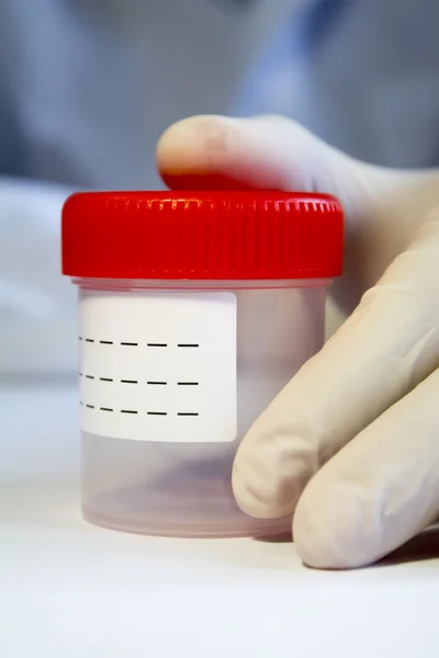 Hands in medical gloves holding empty plastic container for coll — Stock Photo, Image