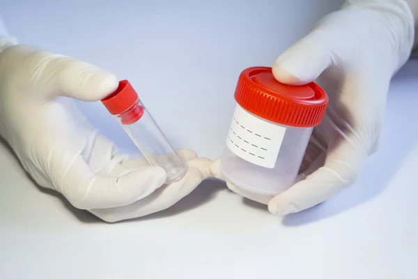 Hands in medical gloves holding different empty plastic containe — Stock Photo, Image