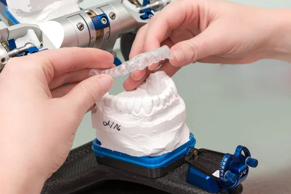 Alinhador removível em laboratório odontológico — Fotografia de Stock