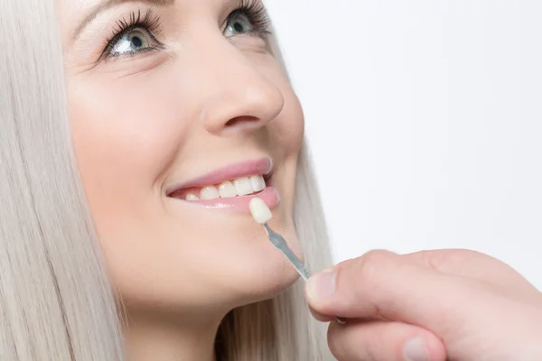 Проверка шпона зубной короны — стоковое фото