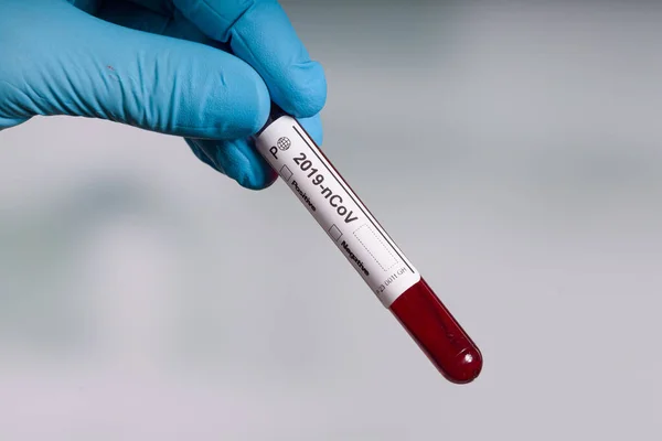 Mão Luvas Azuis Segurando Tubo Teste Sangue Para Testes Coronavírus — Fotografia de Stock