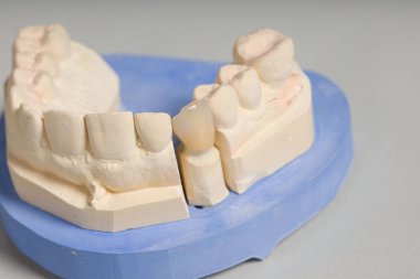 Bir diş laboratuarının çalışma tezgahında yapay diş kullanımına hazır bir şekilde kapat