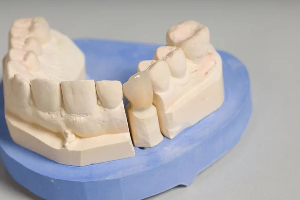 Primo Piano Una Dentizione Artificiale Pronta Uso Banco Lavoro Laboratorio — Foto Stock