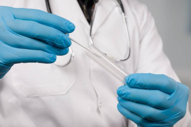 Bir tıp laboratuarında doktor eli ile yapılan karalama testini kapatın. 