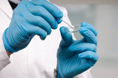 Bir tıp laboratuarında doktor eli ile yapılan karalama testini kapatın. 