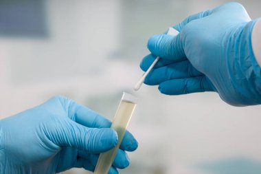 Bir tıp laboratuarında Coronavirus smear testi yapan doktorların ellerini kapatın. 