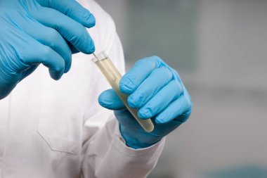 Bir tıp laboratuarında Coronavirus smear testi yapan doktorların ellerini kapatın. 