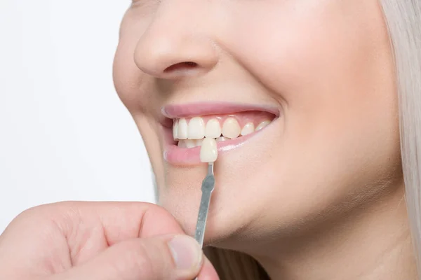 Close Dentist Using Shade Guide Woman Mouth Check Bleaching Grade — Stock Photo, Image