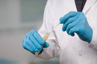 Coronavirus teşhisi için bir tıp laboratuarında karalama testi yapan bir bilim adamının elleri kapalı.