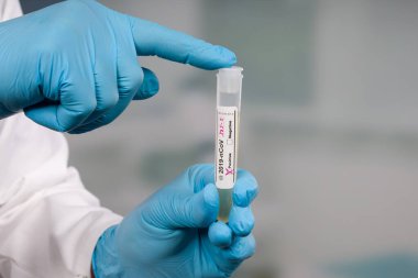Coronavirus tespiti için bir tıp laboratuarında yapılan karalama testine bakan doktorların ellerini kapatın.