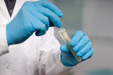 Bir tıp laboratuarında karalama testi yapan bilim adamının ellerini kapatın. 