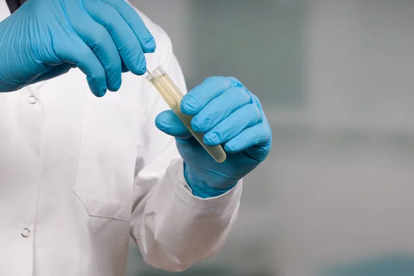 Close Das Mãos Cientista Manipulando Teste Esfregaço Laboratório Médico — Fotografia de Stock