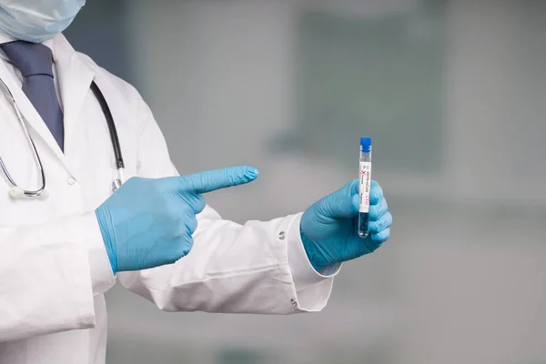 Χέρι Του Γιατρού Του Επιστήμονα Που Παρουσιάζει Θετική Δοκιμασία Κορώνας — Φωτογραφία Αρχείου