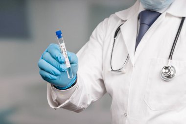 Doktor ya da bilim adamının eli negatif bir korona testi sunuyor.