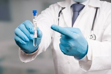 Doktor ya da bilim adamının eli negatif bir korona testi sunuyor.