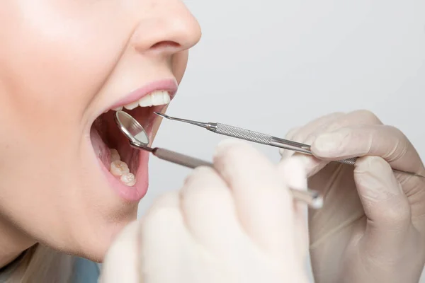 close up of mouth of woman at examination in dentistry / at the dentist