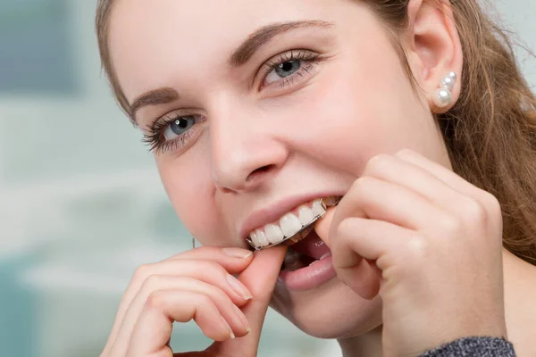 Ung Flicka Sätter Löstagbar Tandställning — Stockfoto