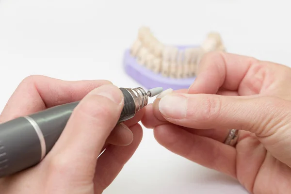 在牙科实验室用电动工具对假牙零件和背景假牙零件进行详细的研究 — 图库照片