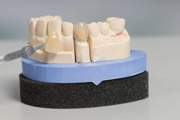 Diş Laboratuarının Tezgahındaki Yapay Diş Kaplamasını Kontrol — Stok fotoğraf