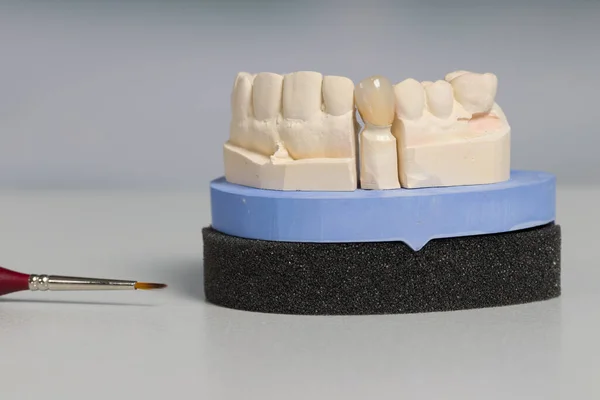 Tezgahtaki Bir Diş Laboratuvarında Yapay Dişler Diş Izleri Üzerine Resim — Stok fotoğraf