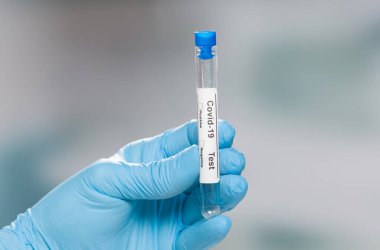 Mavi eldivenleri verin. Coronavirus testi için boş bir tüp tutuyorlar.