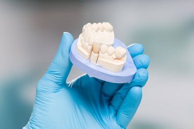 Diş hekiminin elini kapat ve takma dişini kullanmaya hazır olduğunu göster.