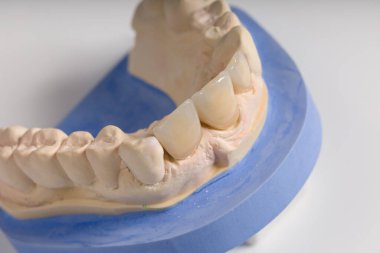 Kullanıma hazır bir çalışma tezgahındaki bir diş laboratuarındaki yapay diş izini kapat