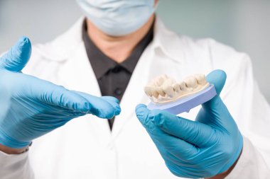 Diş hekimi / diş teknisyeninin eldiveni kullanıma hazır yapay dişli bir diş izi sunuyor.  