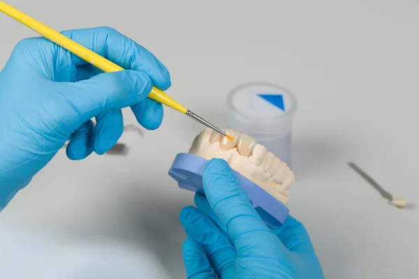 Perto Trabalho Pintura Dentição Artificial Com Pincel Laboratório Odontológico — Fotografia de Stock