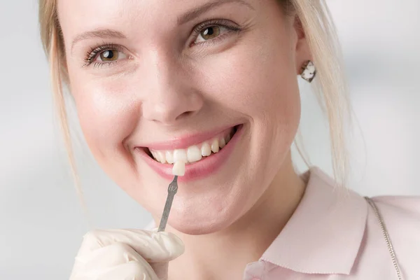 Close Dentist Using Shade Guide Woman Mouth Check Veneer Implants — Stock Photo, Image